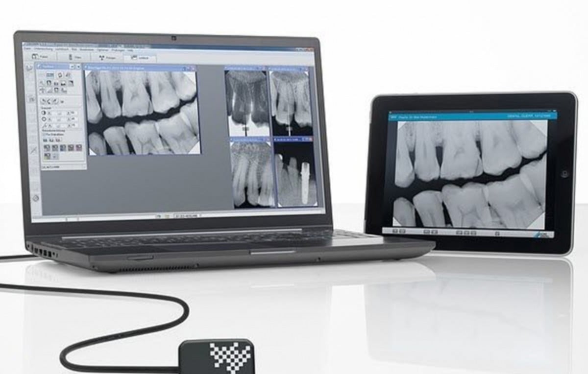 notebook e tablet mostrando exames de uma clínica de radiologia digital