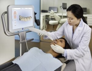 Escaneamento Intraoral