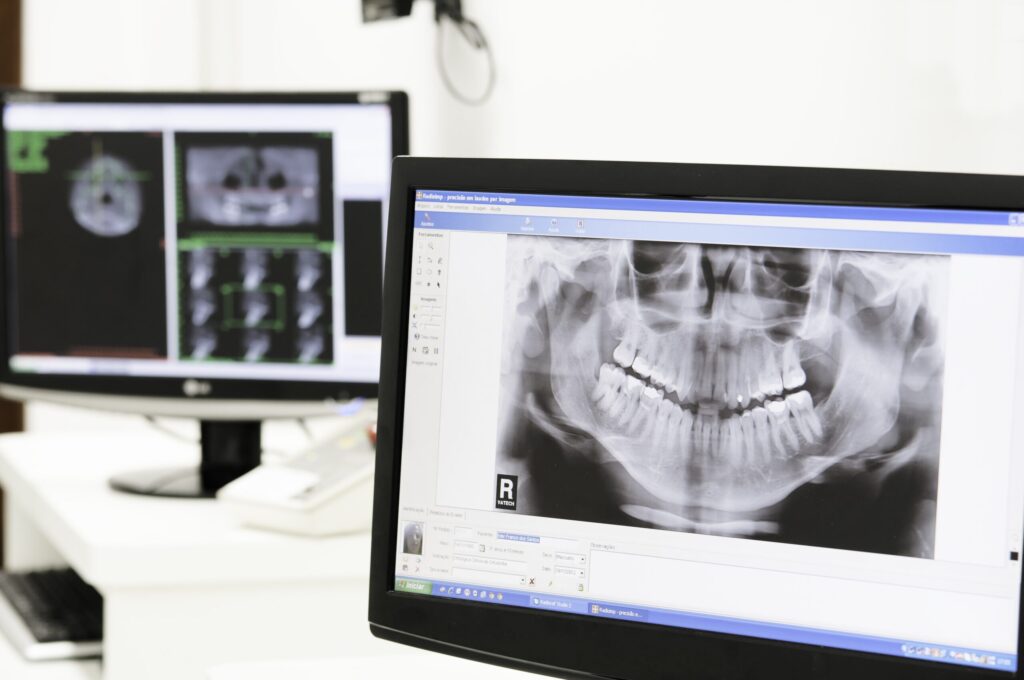 Radiologia Odontológica Radiologia Odontológica