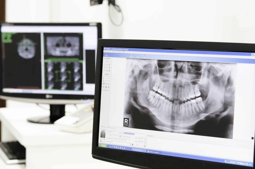 Exames odontológicos digitais