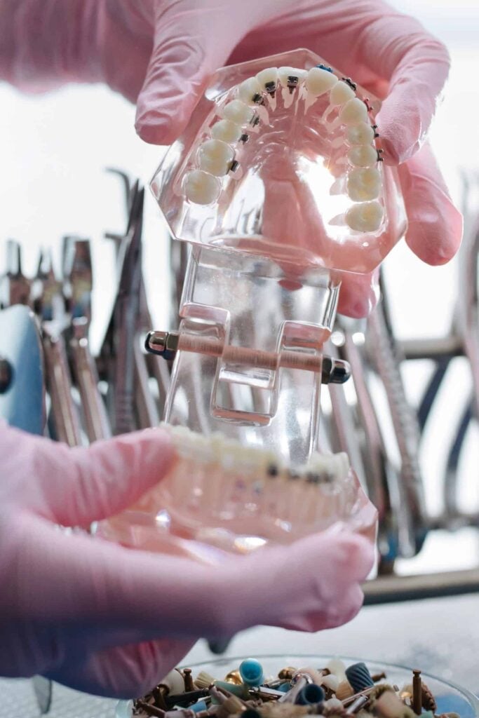 cimento odontológico cimento odontológico