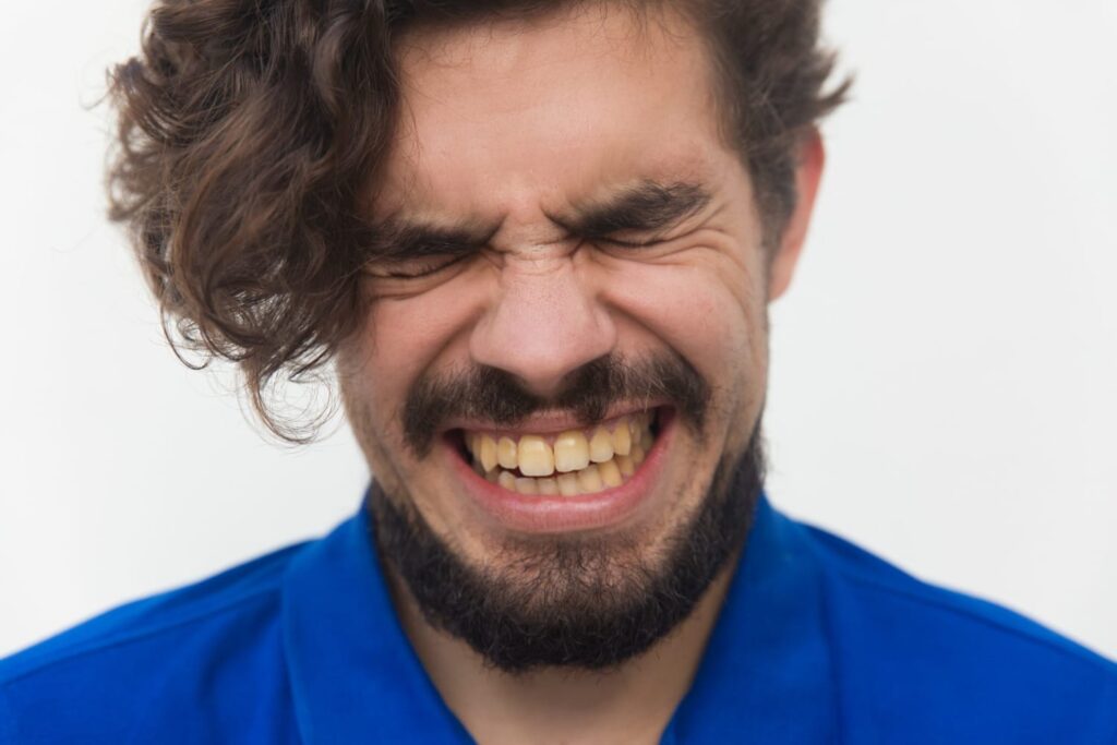 dentes amarelados