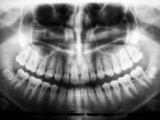 diferenca-entre-tomografia-e-radiografia-1