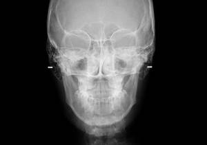 dv0_telerradiologia
