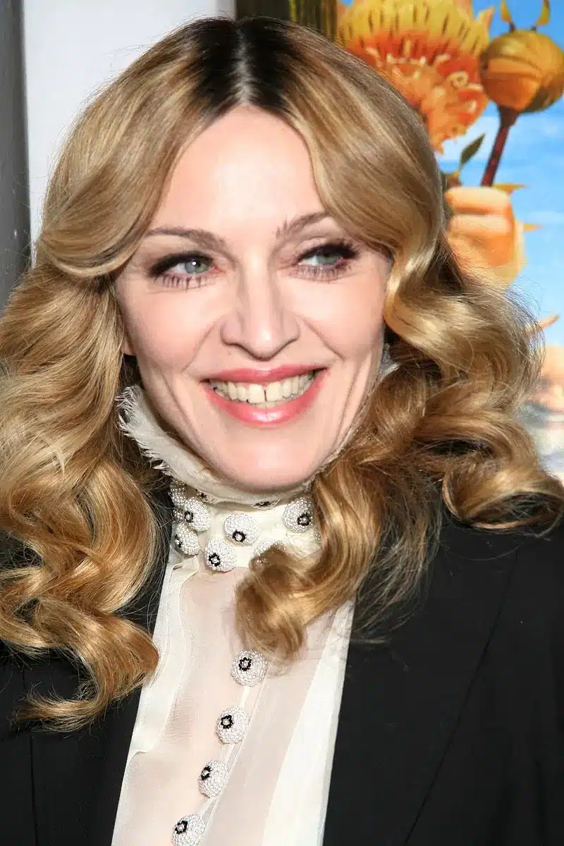 fechamento de diastema