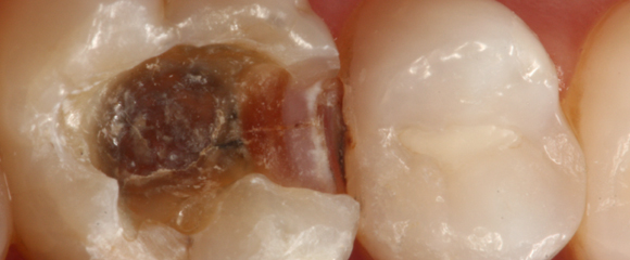 Fotografia odontológica