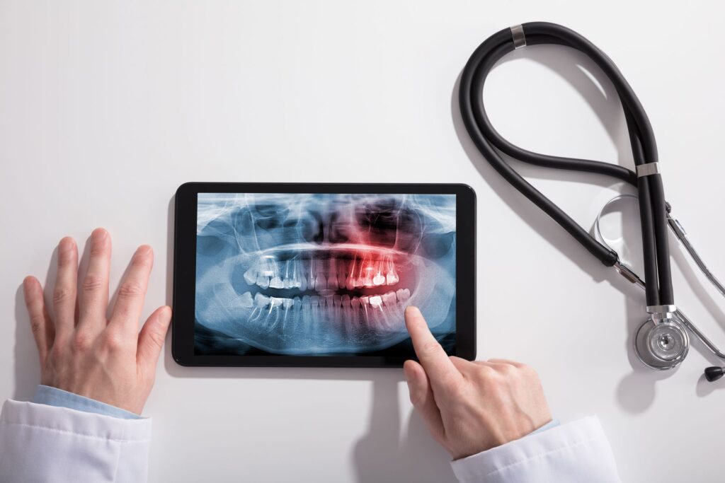 radiografia digital