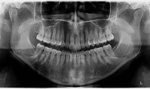 Radiografia Panorâmica