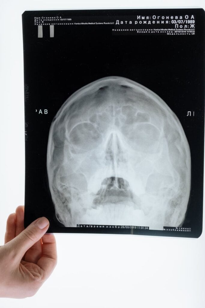 telerradiografia odontológica telerradiologia odontológica