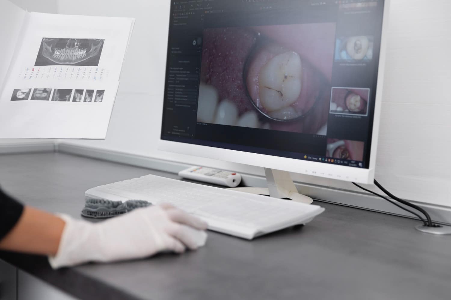 tomografia computadorizada maxilar