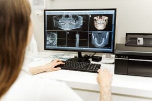 Monitor exibindo imagem 3D de tomografia odontológica