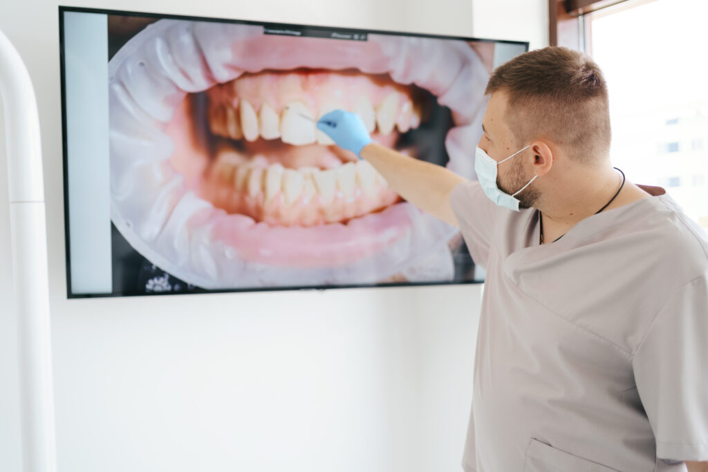 escaneamento intraoral