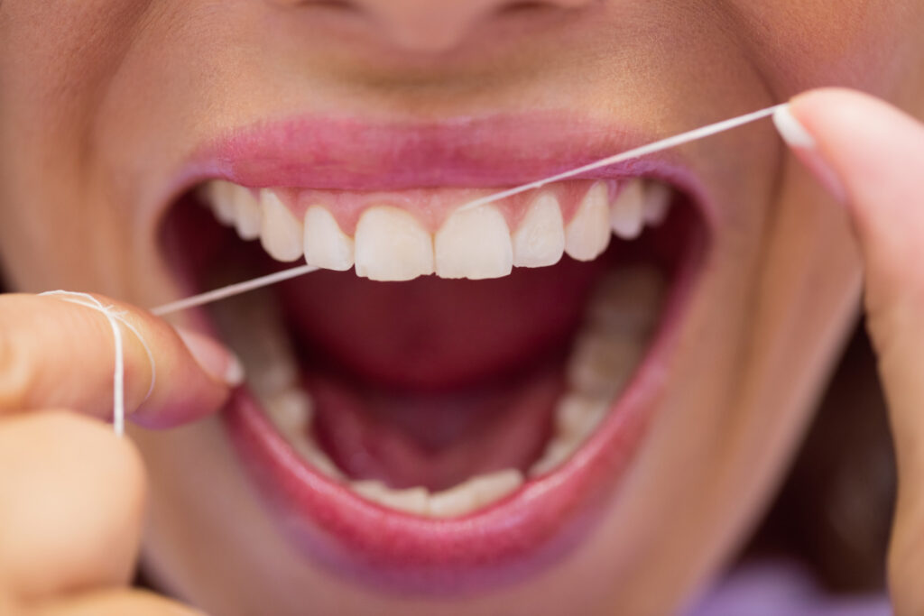 Higiene interdental