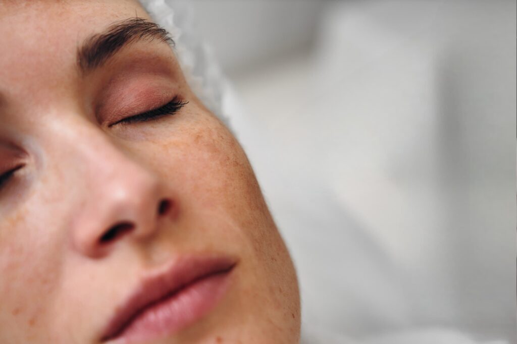 Radiofrequência no tratamento de melasma: evidências clínicas
